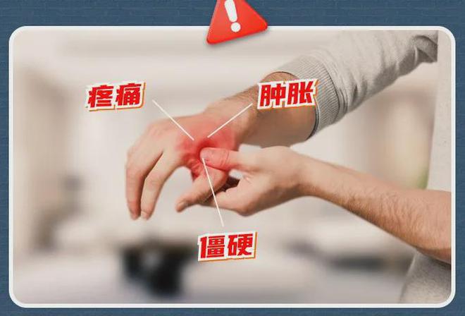 ！手酸、手麻、腱鞘问题推荐用它！千亿球友会app小米生态杀疯了(图9)